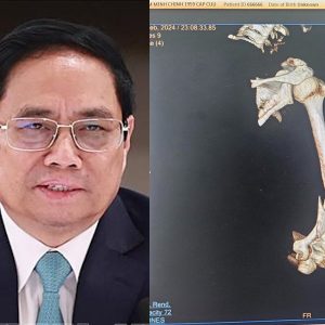 Prime Minister Pham Minh Chinh broke his arm: traffic accident or assassination?